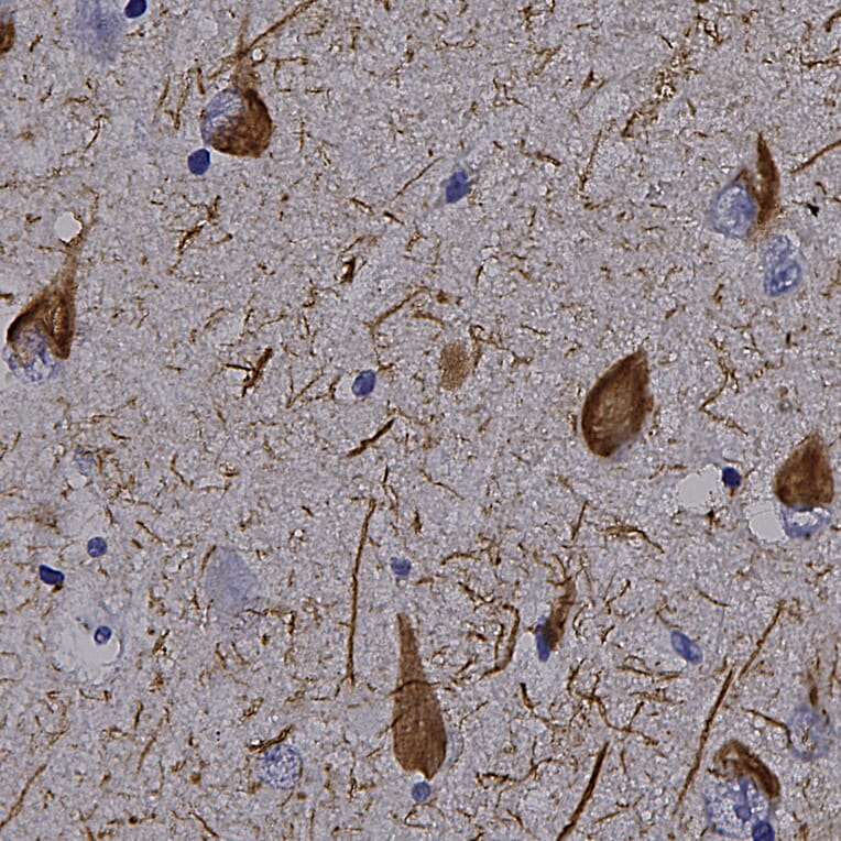 Immunohistochemistry - Anti-Tau Antibody (A85414) - Antibodies.com