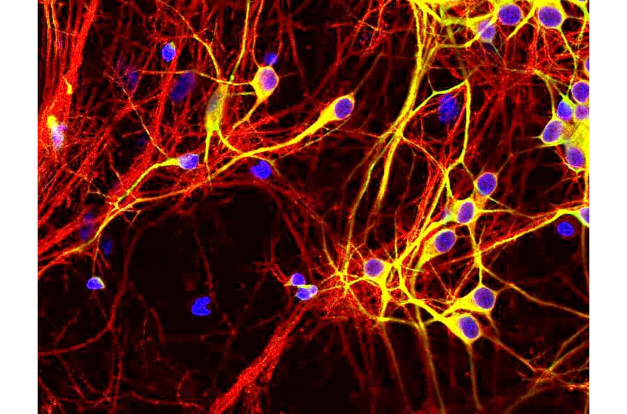 Immunofluorescence - Anti-Tau Antibody [5B10] (A85415) - Antibodies.com