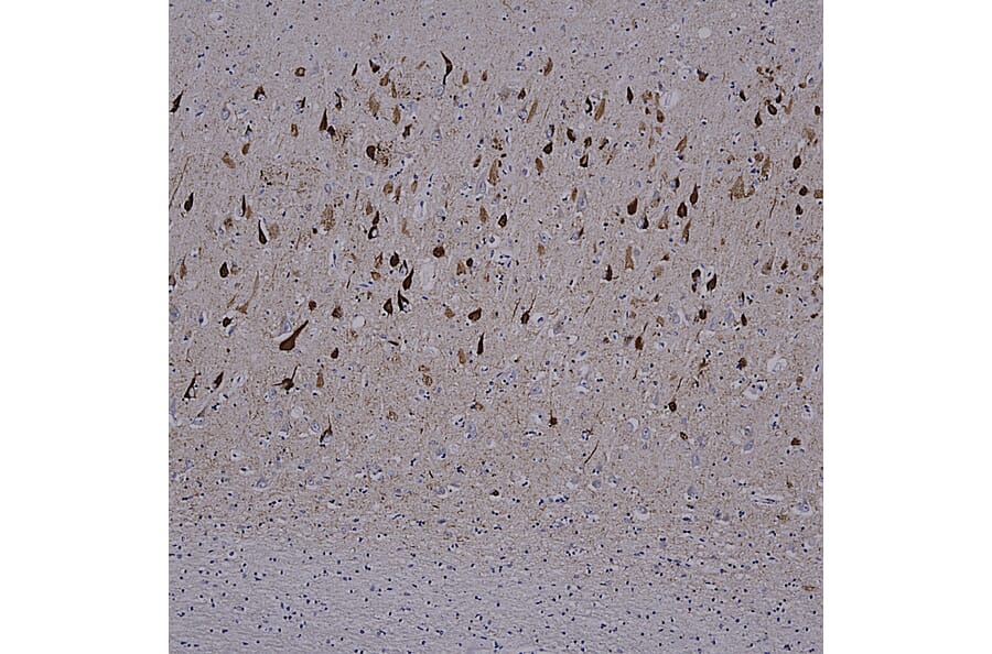 Immunohistochemistry - Anti-Tau Antibody [5B10] (A85415) - Antibodies.com
