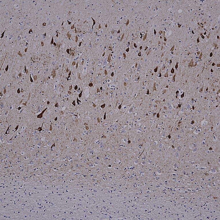 Immunohistochemistry - Anti-Tau Antibody [5B10] (A85415) - Antibodies.com