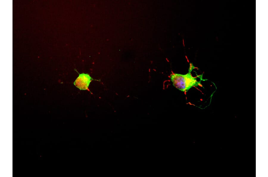 Immunofluorescence - Anti-Tau Antibody [2E9] (A85416) - Antibodies.com