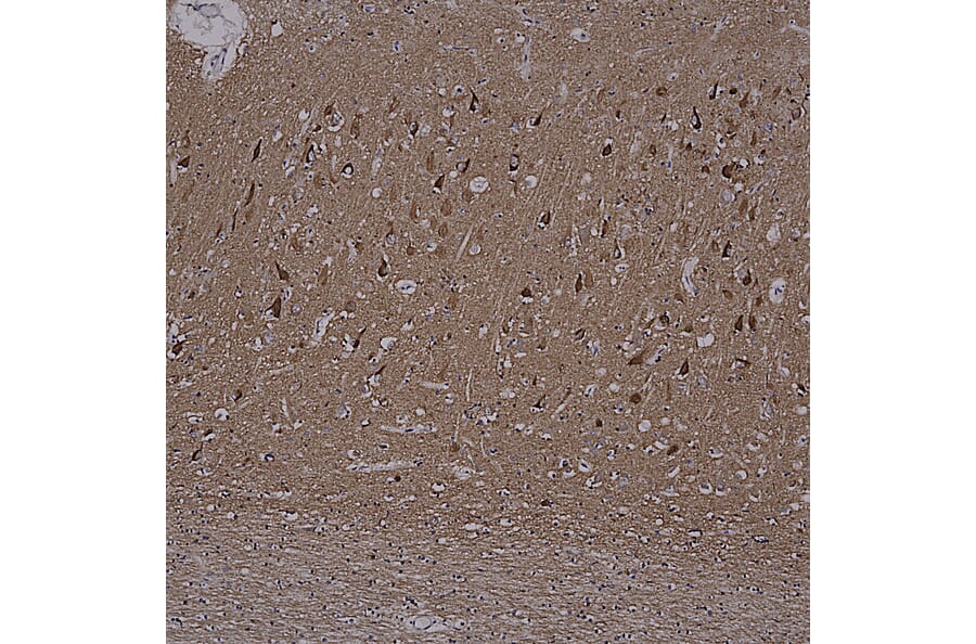 Immunohistochemistry - Anti-Tau Antibody [2E9] (A85416) - Antibodies.com