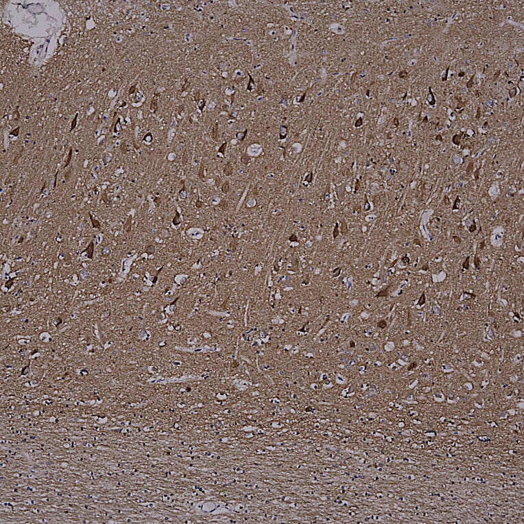 Immunohistochemistry - Anti-Tau Antibody [2E9] (A85416) - Antibodies.com