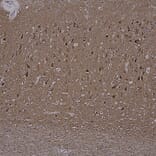 Immunohistochemistry - Anti-Tau Antibody [2E9] (A85416) - Antibodies.com