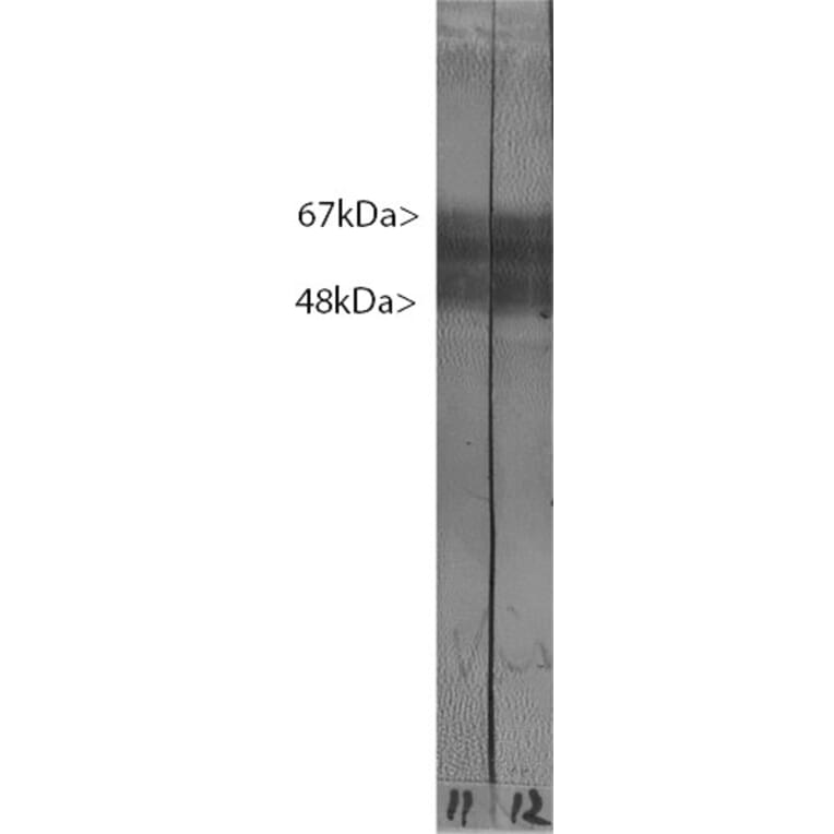 Western Blot - Anti-Tau Antibody [2E9] (A85416) - Antibodies.com
