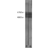 Western Blot - Anti-Tau Antibody [2E9] (A85416) - Antibodies.com