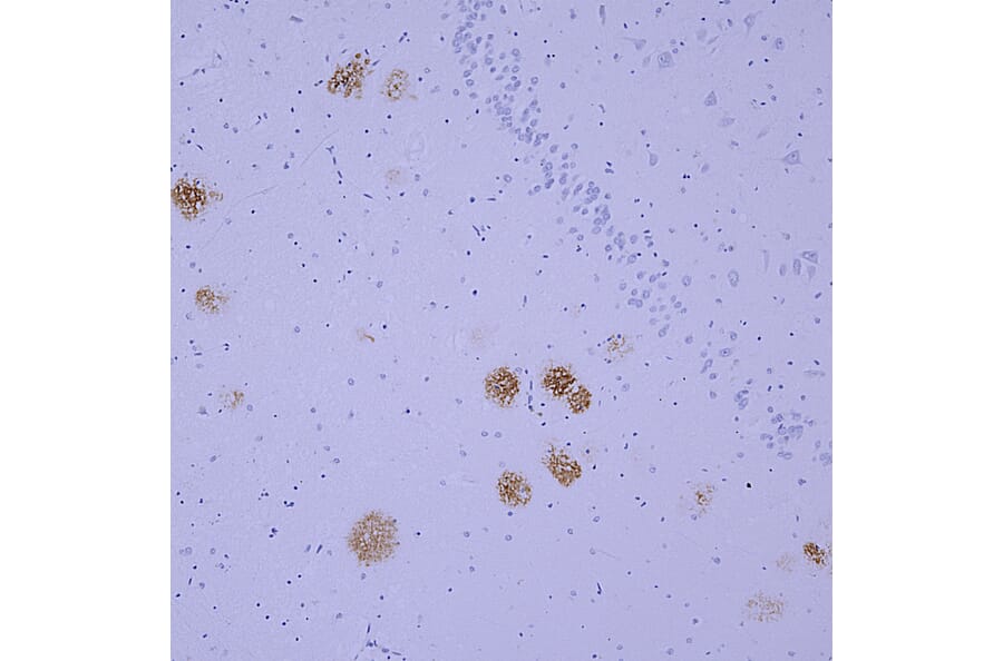 Immunohistochemistry - Anti-beta Amyloid Antibody [AB9] (A85418) - Antibodies.com