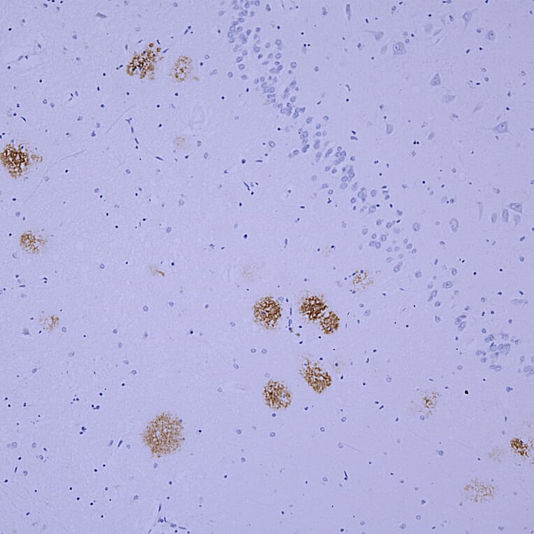 Immunohistochemistry - Anti-beta Amyloid Antibody [AB9] (A85418) - Antibodies.com