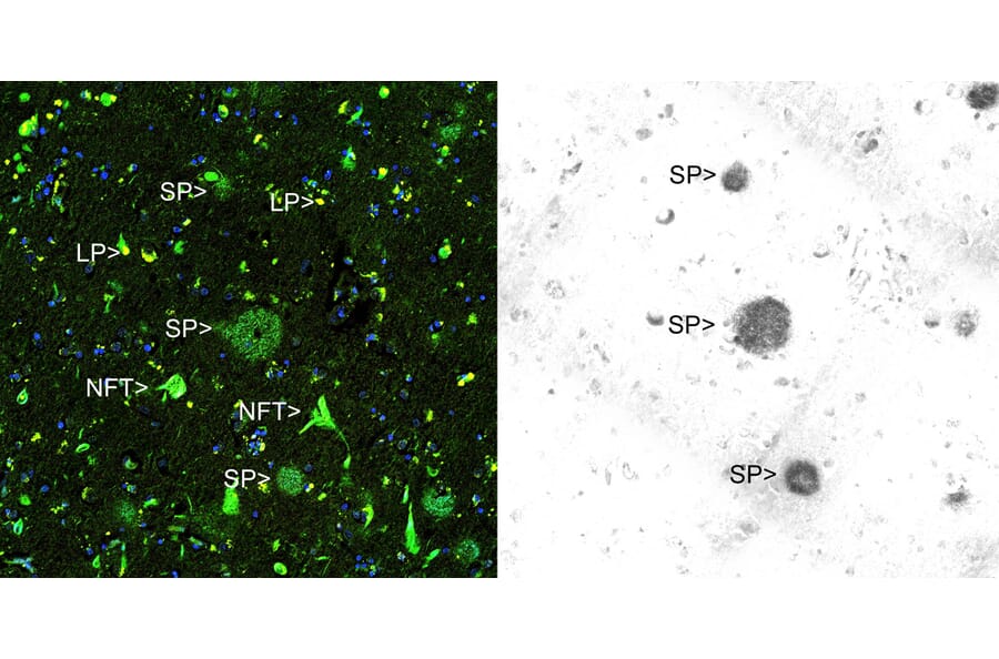 Immunohistochemistry - Anti-beta Amyloid Antibody [AB9] (A85418) - Antibodies.com