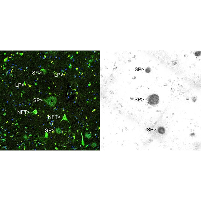 Immunohistochemistry - Anti-Amyloid Aß Antibody (A85418) - Antibodies.com