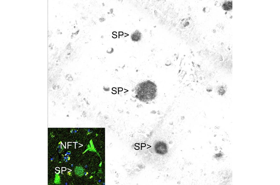 Immunofluorescence - Anti-beta Amyloid Antibody [AB9] (A85418) - Antibodies.com