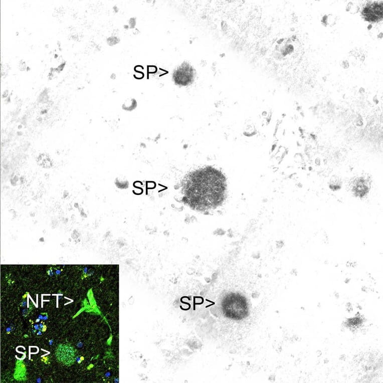 Immunofluorescence - Anti-Amyloid Aß Antibody [AB9] (A85418) - Antibodies.com