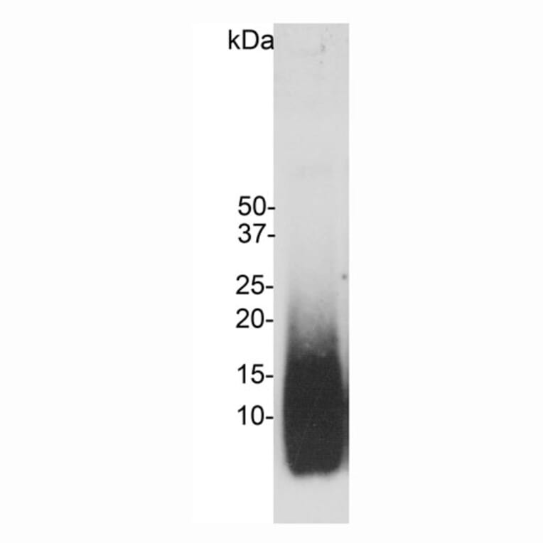 Western Blot - Anti-Amyloid Aß Antibody [AB9] (A85418) - Antibodies.com