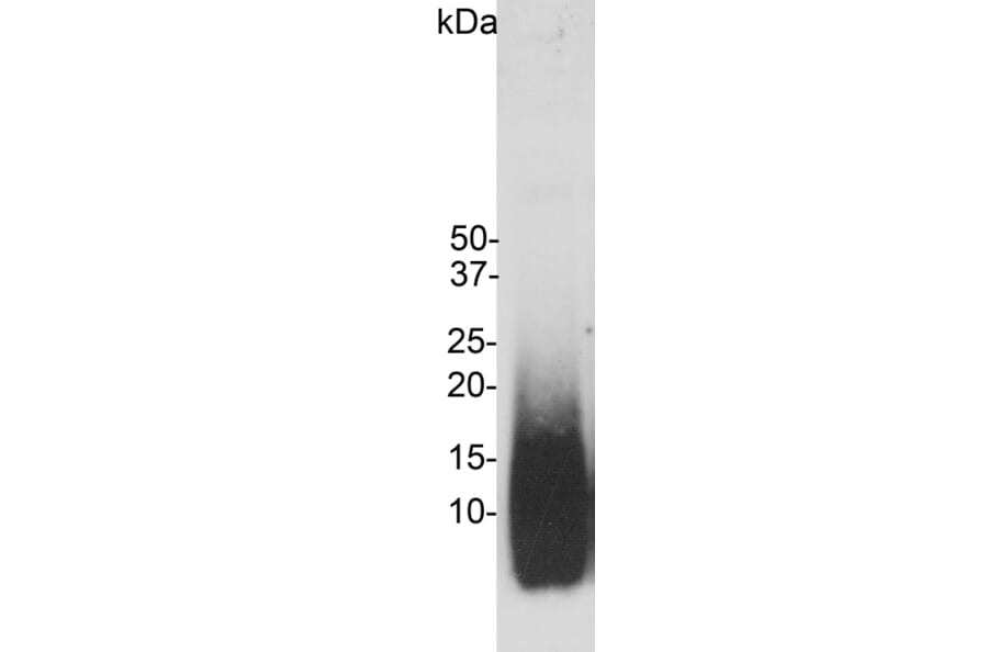 Western Blot - Anti-beta Amyloid Antibody [AB9] (A85418) - Antibodies.com