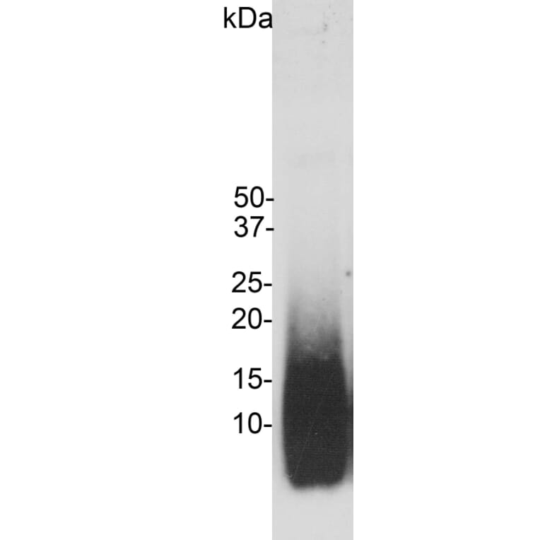 Western Blot - Anti-Amyloid Aß Antibody (A85418) - Antibodies.com