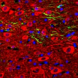 Immunofluorescence - Anti-GFAP Antibody (A85419) - Antibodies.com