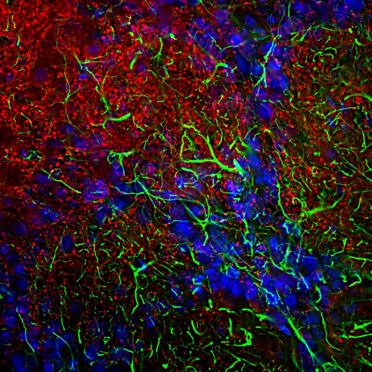 Immunofluorescence - Anti-GFAP Antibody (A85419) - Antibodies.com