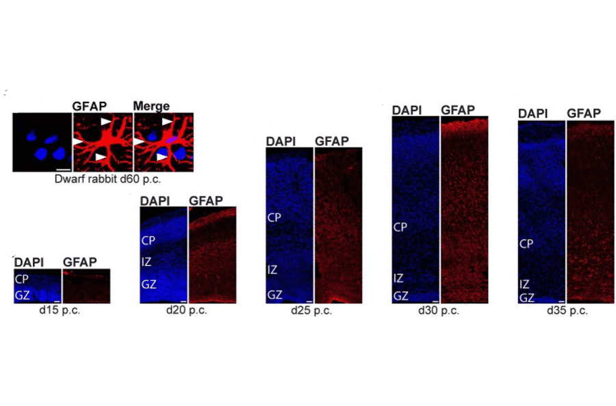Immunofluorescnece - Anti-GFAP Antibody (A85419) - Antibodies.com