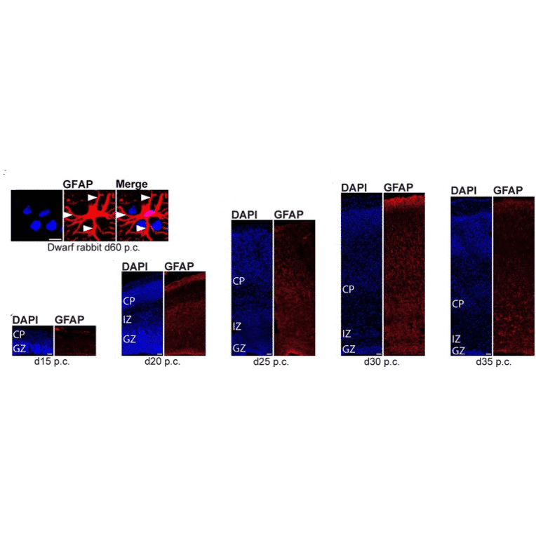 Immunofluorescnece - Anti-GFAP Antibody (A85419) - Antibodies.com