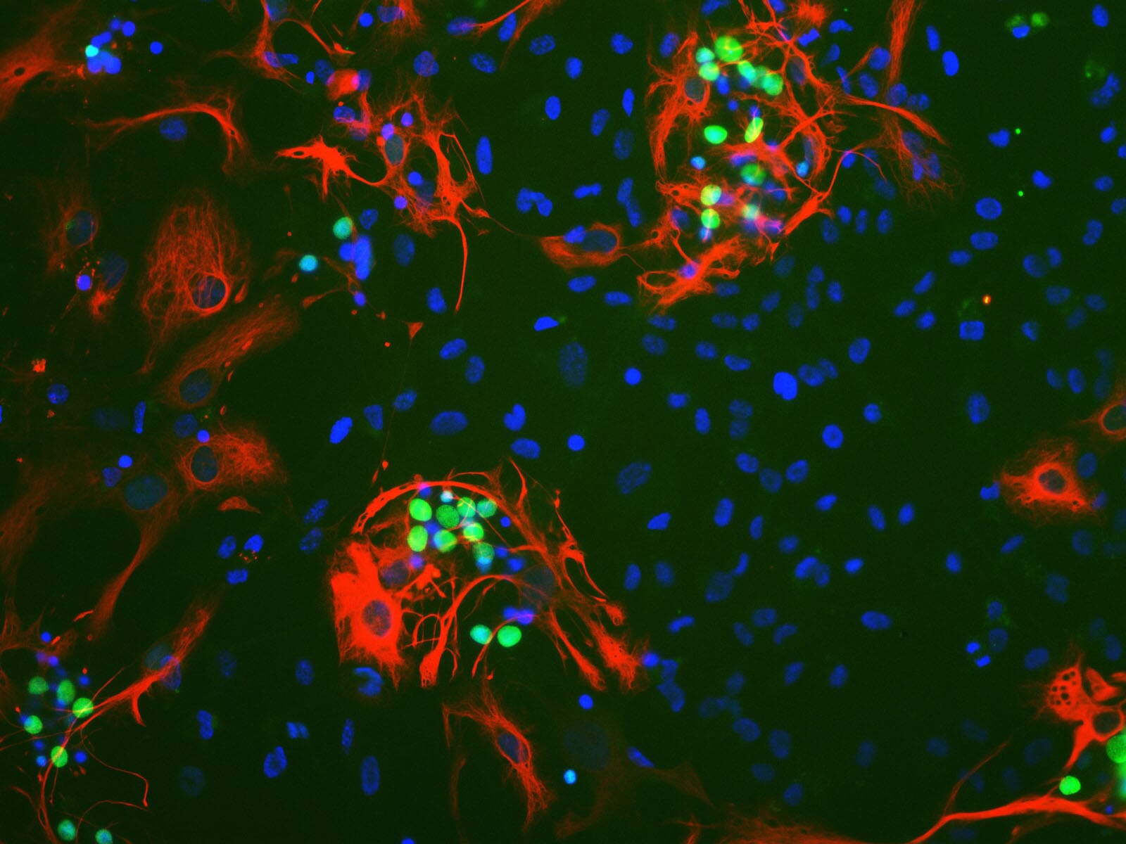 myckyページ Anti-GFAP Antibody (A85419) | Antibodies.com