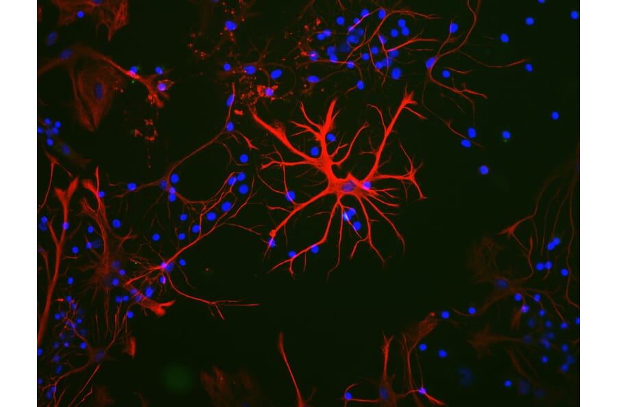 Immunofluorescence - Anti-GFAP Antibody (A85419) - Antibodies.com