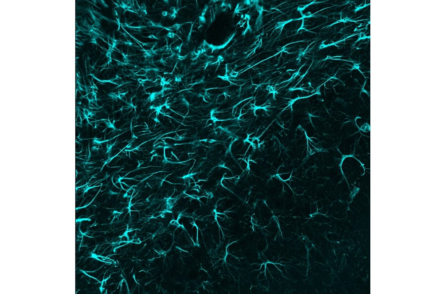 Immunofluorescence - Anti-GFAP Antibody (A85419) - Antibodies.com
