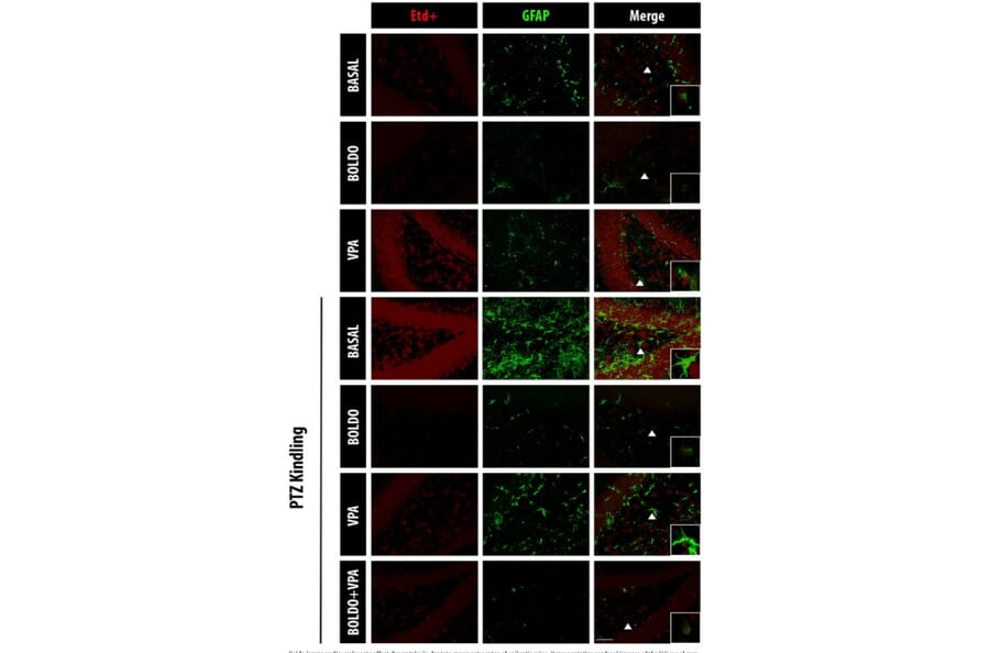 Immunofluorescence - Anti-GFAP Antibody (A85419) - Antibodies.com