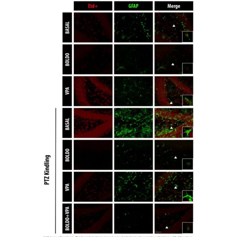Immunofluorescence - Anti-GFAP Antibody (A85419) - Antibodies.com
