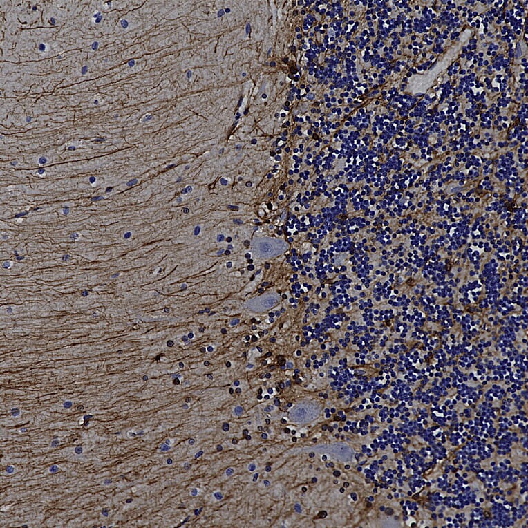 Immunohistochemistry - Anti-GFAP Antibody (A85419) - Antibodies.com