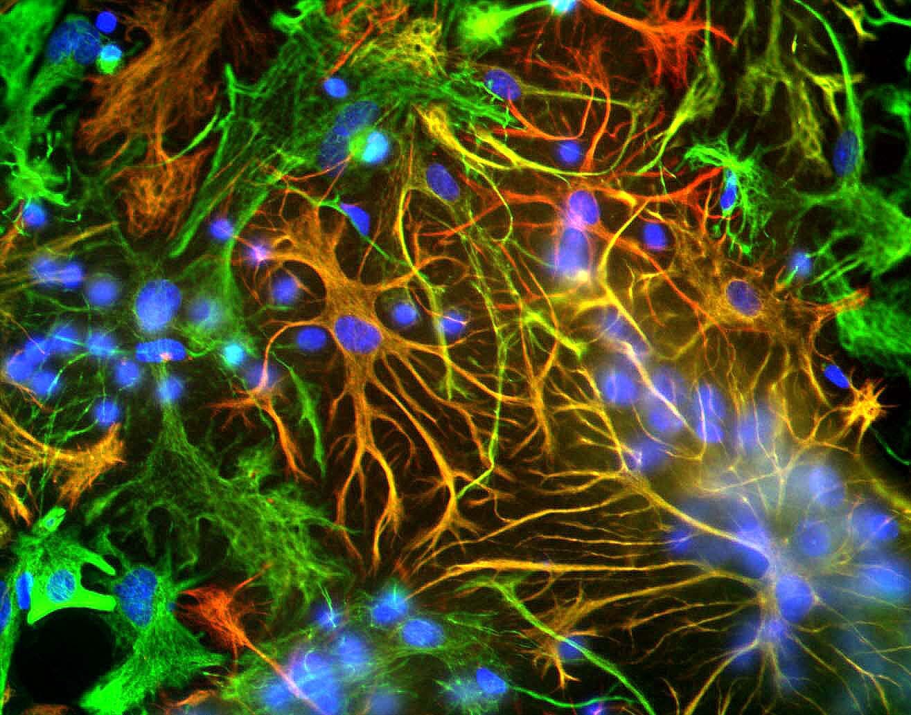 Mixed neuron-glial cultures stained with Anti-GFAP Antibody (red) and Anti-Vimentin Antibody (A85421 | green). The fibroblastic cells contain only vimentin and so are green, while astrocytes contain either vimentin and GFAP, so appear golden, or predominantly GFAP, in which case they appear red. Blue is nuclear DNA stain.