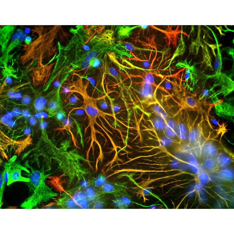 Immunofluorescence - Anti-GFAP Antibody (A85419) - Antibodies.com