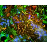 Immunofluorescence - Anti-GFAP Antibody (A85419) - Antibodies.com
