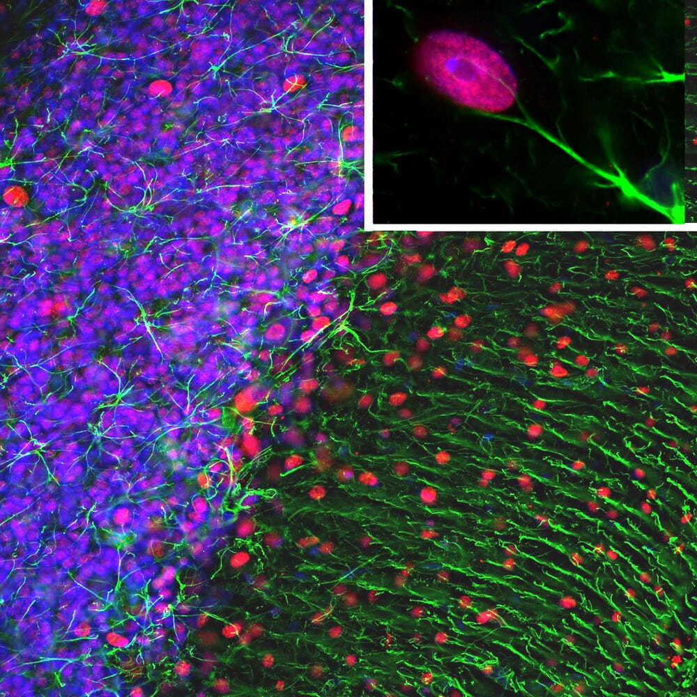 Immunofluorescent analysis of a rat cerebellum section stained with Anti-GFAP Antibody (A85419), at a dilution of 1:5,000, in green, and co-stained with Anti-MeCP2 Antibody (A104324), at a dilution of 1:500, in red. The nuclear DNA is visualised in blue using Hoechst staining. Following transcardial perfusion of the rat with 4% paraformaldehyde, the brain was post-fixed for 1 hour, cut to 45 µm, and free-floating sections were stained with the above antibodies. The Anti-GFAP Antibody (A85419) stains the network of astrocytic cells and the processes of Bergmann glia in the molecular layer. The Anti-MeCP2 Antibody (A104324) specifically labels nuclei of certain neurons.