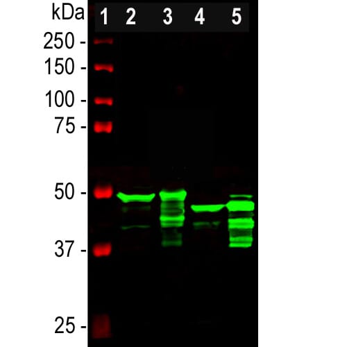 Western blot analysis of different tissue lysates using Anti-GFAP Antibody (A85419), at a dilution of 1:5,000, in green. The lanes contain samples of: <b>[1]</b> Protein standards, in red, <b>[2]</b> rat brain, <b>[3]</b> rat spinal cord, <b>[4]</b> mouse brain, and <b>[5]</b> mouse spinal cord. The strong band at about 50 kDa corresponds to the major isotype of the GFAP protein. Smaller isotypes and proteolytic fragments of GFAP are also detected on the blot.