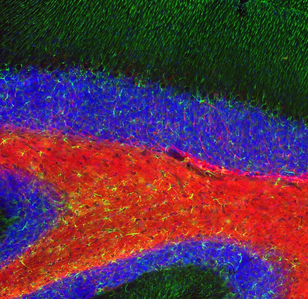 Anti-GFAP Antibody (A85419) | Antibodies.com