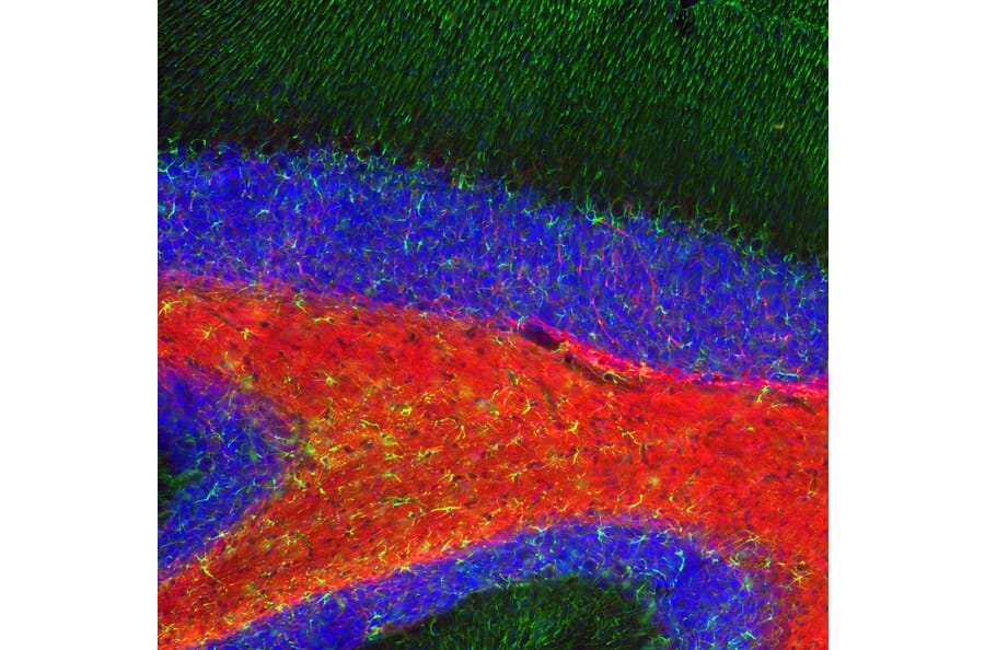 Immunofluorescence - Anti-GFAP Antibody (A85419) - Antibodies.com