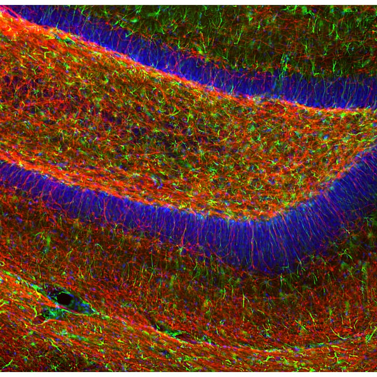 Immunofluorescence - Anti-GFAP Antibody (A85419) - Antibodies.com