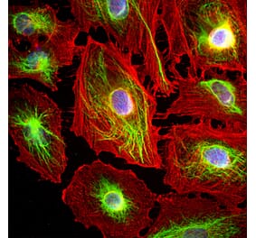 Immunofluorescence - Anti-Vimentin Antibody (A85420) - Antibodies.com