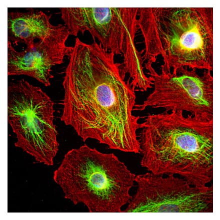 Immunofluorescence - Anti-Vimentin Antibody (A85420) - Antibodies.com