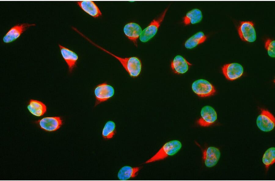 Immunofluorescence - Anti-Vimentin Antibody (A85420) - Antibodies.com