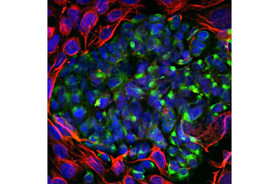 Immunofluorescence - Anti-Vimentin Antibody (A85420) - Antibodies.com