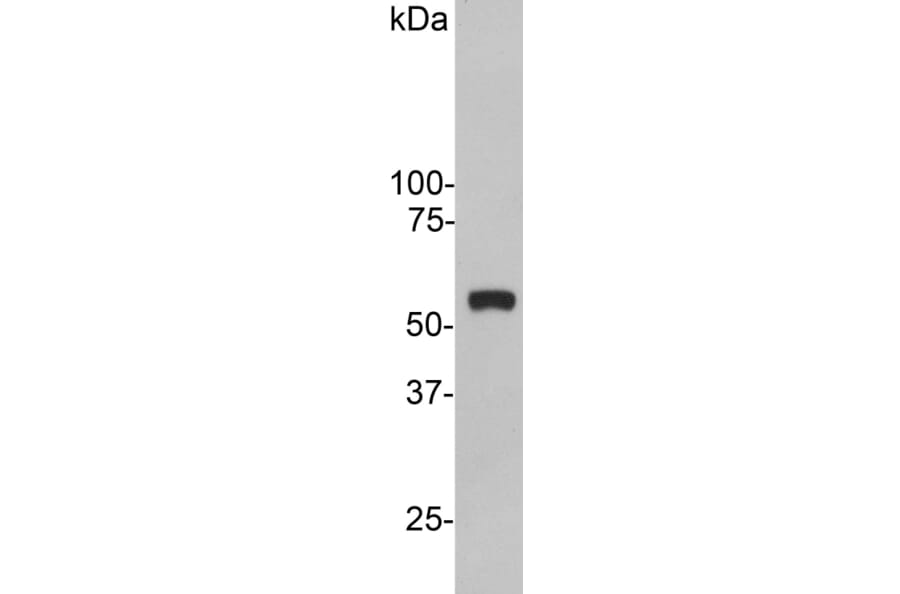 Western Blot - Anti-Vimentin Antibody (A85420) - Antibodies.com