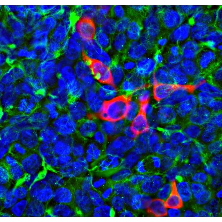 Immunofluorescence - Anti-Vimentin Antibody (A85420) - Antibodies.com