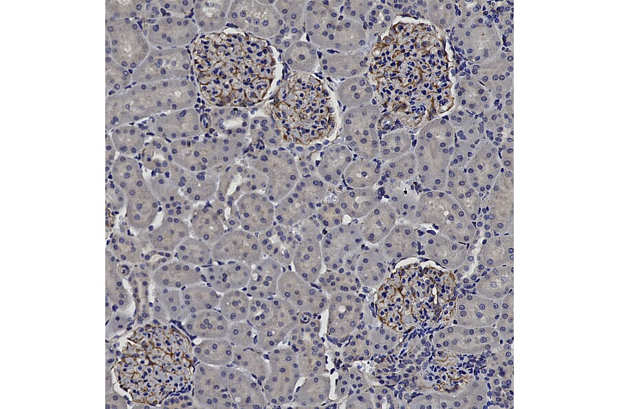 Immunohistochemistry - Anti-Vimentin Antibody (A85420) - Antibodies.com