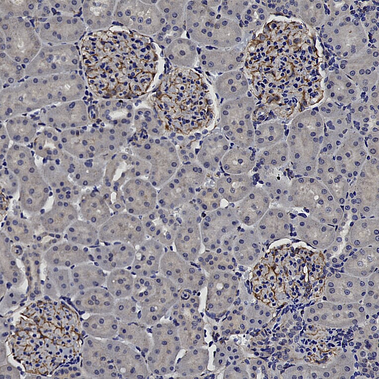 Immunohistochemistry - Anti-Vimentin Antibody (A85420) - Antibodies.com