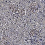 Immunohistochemistry - Anti-Vimentin Antibody (A85420) - Antibodies.com