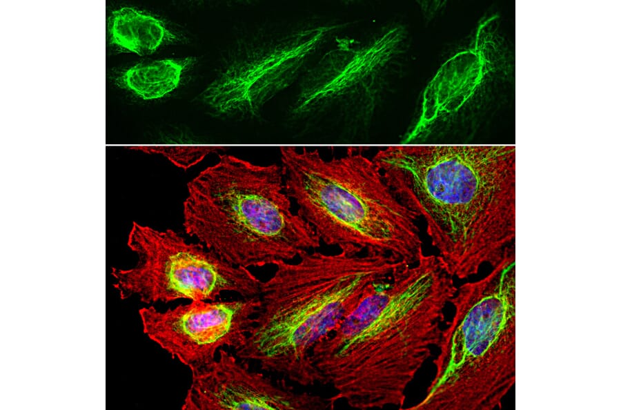 Immunofluorescence - Anti-Vimentin Antibody (A85421) - Antibodies.com