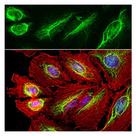 Immunofluorescence - Anti-Vimentin Antibody (A85421) - Antibodies.com