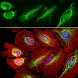 Immunofluorescence - Anti-Vimentin Antibody (A85421) - Antibodies.com