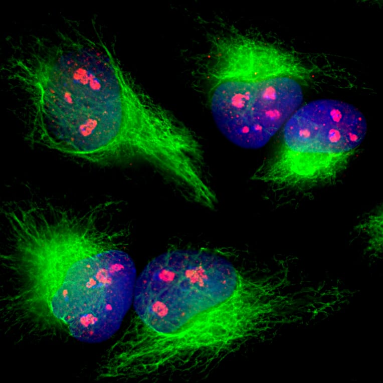 Immunofluorescence - Anti-Vimentin Antibody (A85421) - Antibodies.com